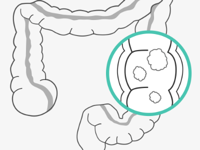 The colorectal system