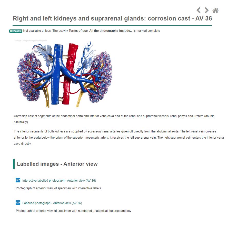 Specimen page showing renal corrosion cast