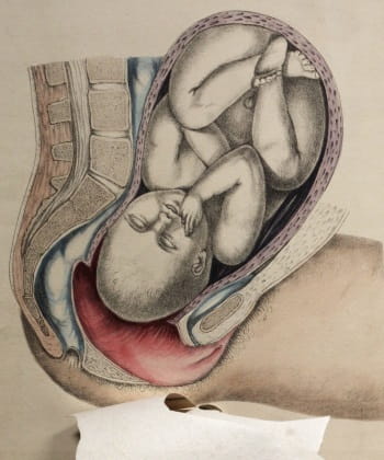 Obstetric Tables 6: baby