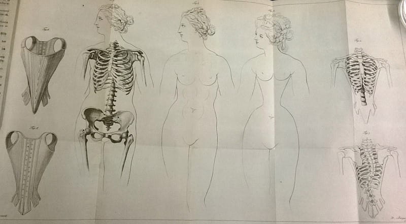 Medical effects of corset wearing, 19th Century illustration - Stock Image  - C036/8446 - Science Photo Library