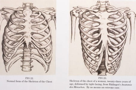 Rib cages