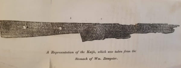 A statement of the case of Wm. Dempster, a juggler who died in consequence of having swallowed a table-knife, by Hadfield, G. J. (1824) (TRACTS A131(19))