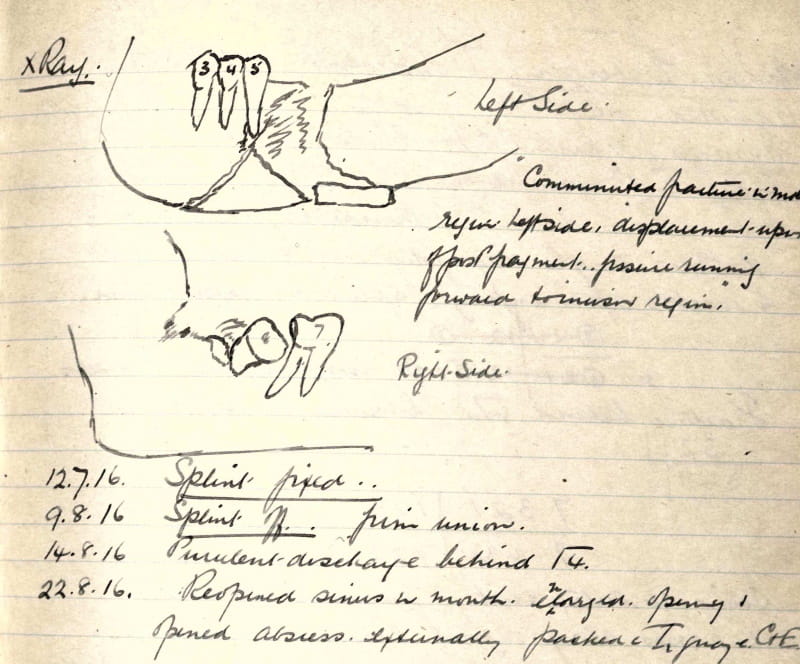 Diagram from MS0298/2