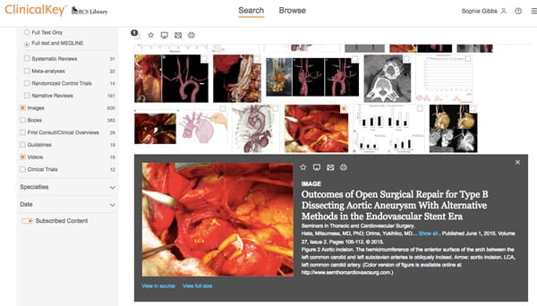 ClinicalKey Images 2: image results