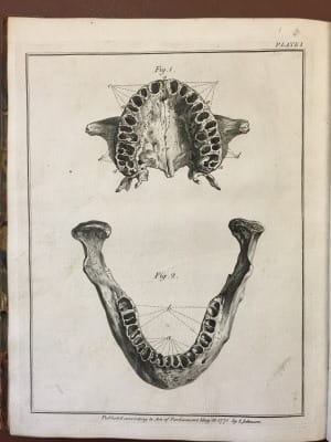  John Hunter - The natural history of the human teeth 1771