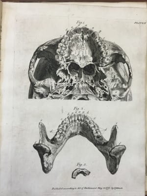  John Hunter - The natural history of the human teeth 1771