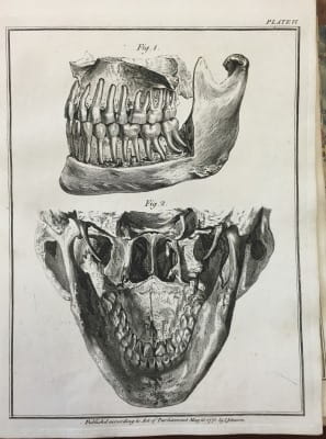  John Hunter - The natural history of the human teeth 1771