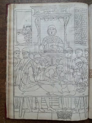 RCS copy Johannes de Ketham Fasciculus Medicinae 1495 latin ed. dissection scene