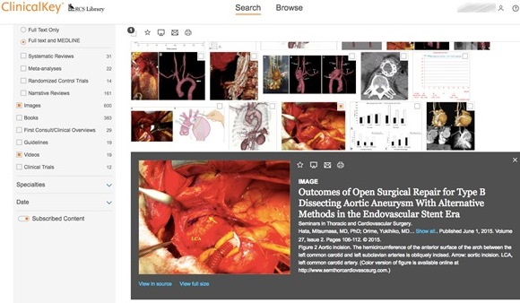 Saved image collection in ClinicalKey