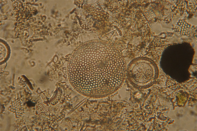 Microscopic diatoms