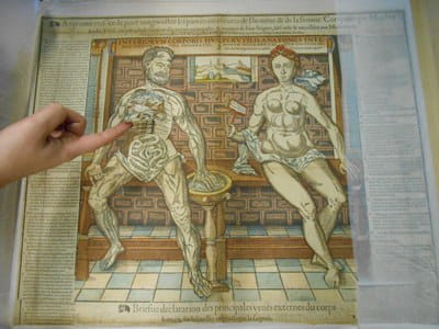 Fugitive sheet - Anatomie tres utile, Paris, par Jean de Gourmont, 1585